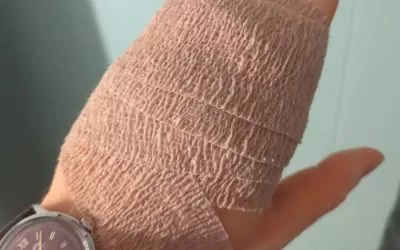 Hand surgery, be back soon!